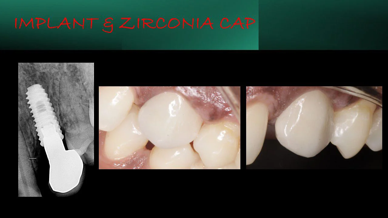 Real Patient Story – Before & After