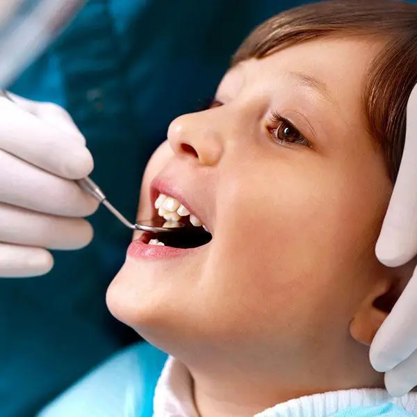 teeth-whitening-thumbnail