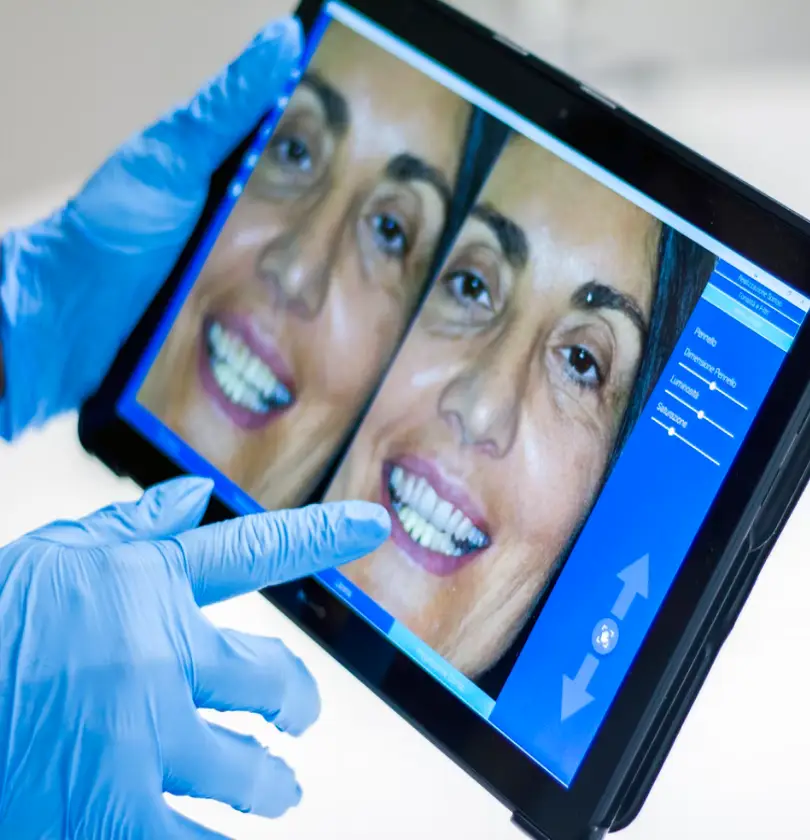 teeth-whitening-thumbnail