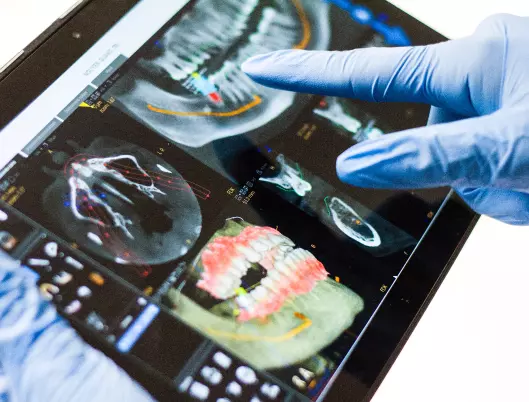 dental xray